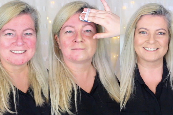 Så Förbereder du Mogen Hud med Rosacea för Makeup